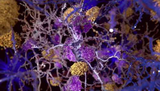 NMN Revers es Signs of Aging in Older Women