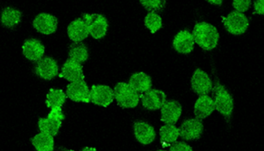 NMN Improves Cognitive Deficits in Alzheimer's Mice