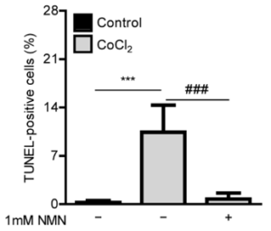 NMN rescues retinal cells from death in the face of oxidative stress NMN rescues retinal cells from death in the face of oxidative stress