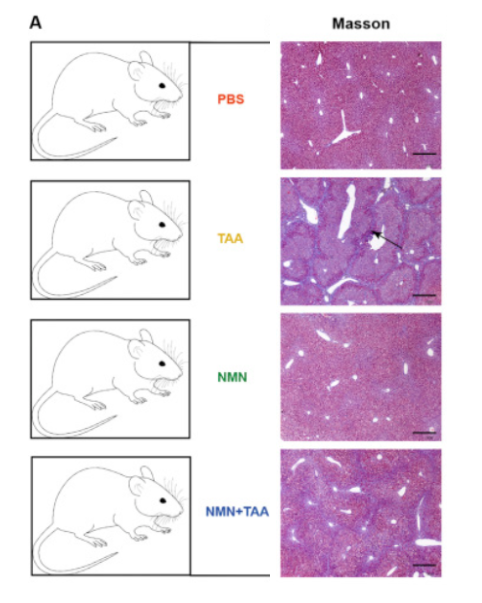 NMN prevented liver fibrosis in mice treated with thioacetamide NMN prevented liver fibrosis in mice treated with thioacetamide