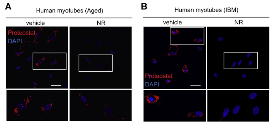 Boosting NAD+ levels reduces amyloid-like deposits in human muscle cells Boosting NAD+ levels reduces amyloid-like deposits in human muscle cells