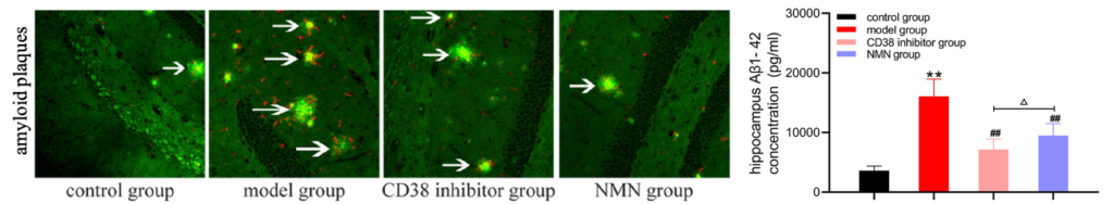 NMN and CD38 Inhibition Rid the Brain of A beta. NMN and CD38 Inhibition Rid the Brain of A beta.