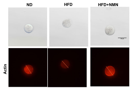 NMN restores actin structural protein abundance NMN restores actin structural protein abundance