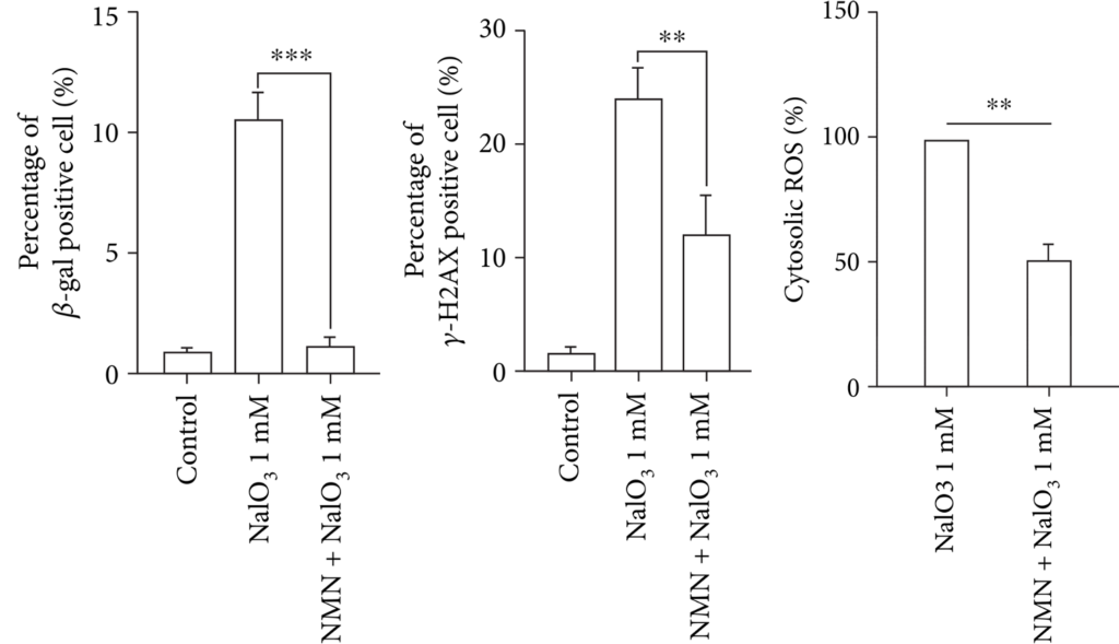 NMN Reduces Senescence in Degenerated Human Retina Cells. NMN Reduces Senescence in Degenerated Human Retina Cells.
