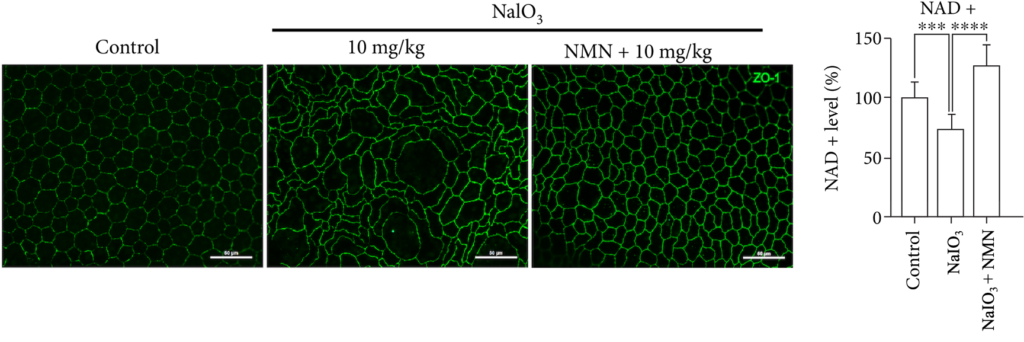 NMN Prevents Degenerated Mouse Retina Structural Changes. NMN Prevents Degenerated Mouse Retina Structural Changes.
