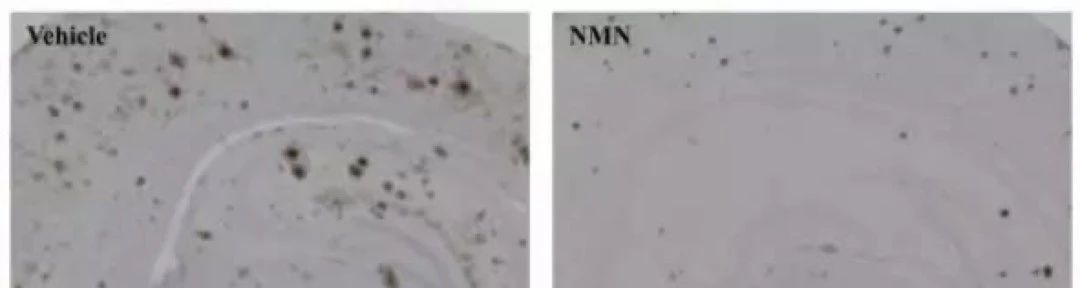 NMN significantly reduced the plaques formed by β-amyloid in brain tissue NMN significantly reduced the plaques formed by β-amyloid in brain tissue