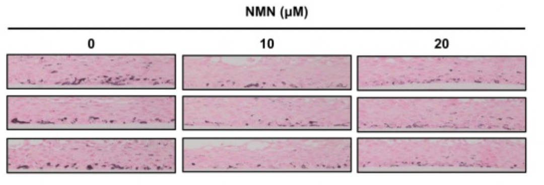 the same dose of NMN for three months had little effect on newborn melanocytes. the same dose of NMN for three months had little effect on newborn melanocytes.