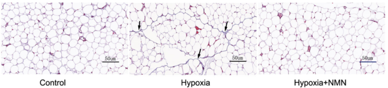 NMN attenuates adipose tissue fibrosis under hypoxic conditions NMN attenuates adipose tissue fibrosis under hypoxic conditions