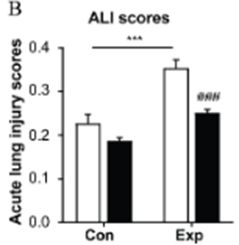 NMN prevents acute lung injury (ALI) in PM-exposed mice. NMN prevents acute lung injury (ALI) in PM-exposed mice.