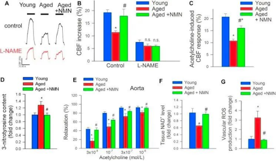 Figure: NMN improves microvascular endothelial function and rescues neurovascular coupling in aged mice Figure: NMN improves microvascular endothelial function and rescues neurovascular coupling in aged mice