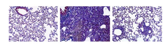 From left to right: normal, silica-injured, and NMN-treated silica-injured lung tissue stained for scarring (purple) From left to right: normal, silica-injured, and NMN-treated silica-injured lung tissue stained for scarring (purple)