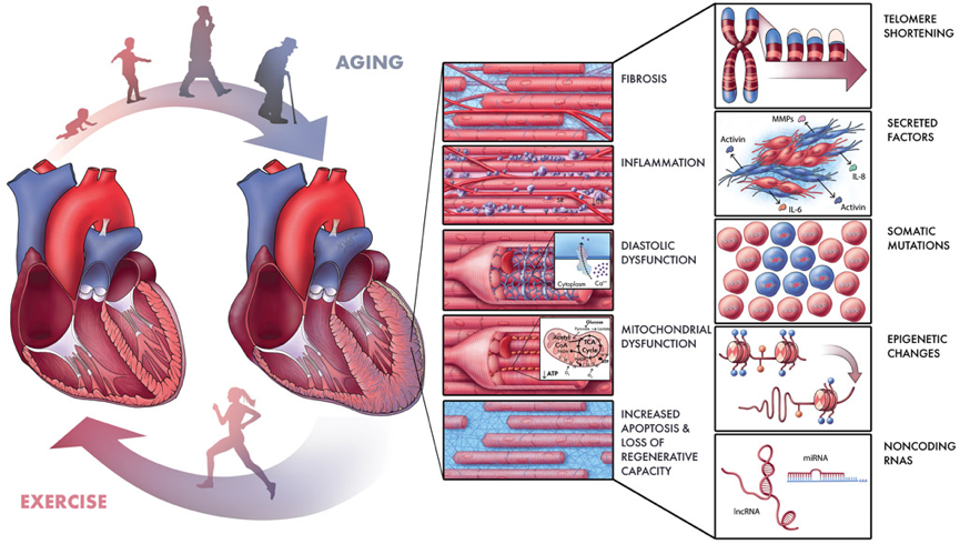 Figure: Heart disease processes associated with aging Figure: Heart disease processes associated with aging