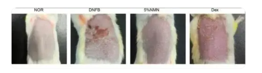 NMN can prevent skin damage caused by inflammation NMN can prevent skin damage caused by inflammation