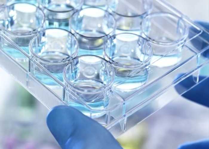 What is the function of NR?